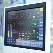 EKG Monitoring