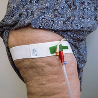 Dale Hold-N-Place Dale Medical Products 330-Dale Leg Strap, Up to 56 Inches, Urological Accessories