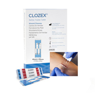 Clozex Clozex Medical CL1040L-Skin Closure Device Clozex 1-1/2 x 2 in Polyurethane, Polyester, Medical Grade Acrylic (BX/10)