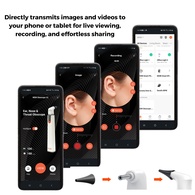 MOBI 70676 Smart Wi-Fi ENT Otoscope with HD Camera